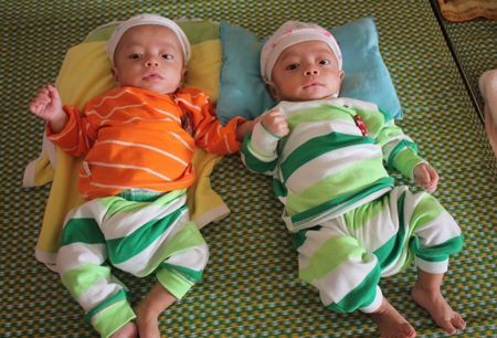 Nỗi lòng người mẹ sinh ba: Một con mất, hai con nguy kịch - 1 7 tháng tuổi, Hoàng và Bảo chỉ như bé hơn 1 tháng tuổi do bị suy dinh dưỡng nặng