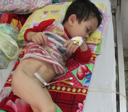 Nghị lực phi thường của bé 5 tuổi bị u bạch huyết trực tràng - 2 Mặc dù rất đau nhưng cậu bé tuyệt nhiên không khóc lóc hay kêu ca.