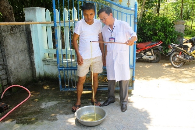 Phát hiện sán xơ mít “khủng” dài 12m trong ruột người - 5 Y sĩ Danh từng chữa trị thành công cho nhiều bệnh nhân mắc sán xơ mít khủng