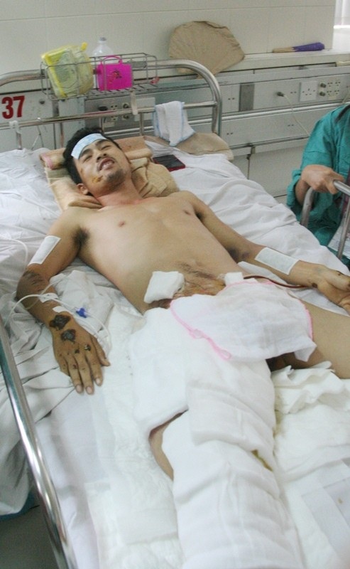 Cứu sống bệnh nhân bị đa chấn thương rất nặng - 1 Bệnh nhân Sáu