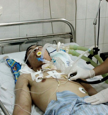 Xử lý vết thương như thế nào để phòng uốn ván? - 1