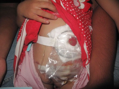 80 trẻ mong được có... bộ phận sinh dục - 2 80 trẻ mong được có... bộ phận sinh dục - 2