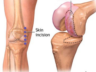 Khám miễn phí các bệnh lý liên quan đến khớp gối - 1