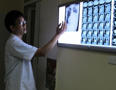 Trâu húc vỡ tim 19 năm vẫn sống sót - 1 Trâu húc vỡ tim 19 năm vẫn sống sót - 1