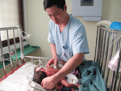 “Cặp song sinh dính nhau rất phức tạp”