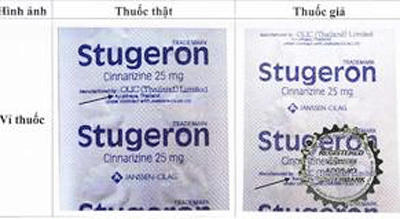 Thuốc Stugeron có hiệu quả trong việc điều trị rối loạn tiền đình không?