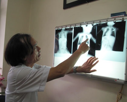 Cứu sống bé 1 tuổi tím đen, hôn mê vì hóc thạch - 1 Cứu sống bé 1 tuổi tím đen, hôn mê vì hóc thạch
