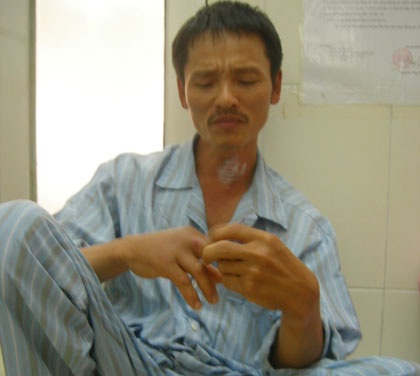 Hà Nội: Nhiều bệnh nhân phải nhập viện vì chuột cắn - 1 Hà Nội: Nhiều bệnh nhân phải nhập viện vì chuột cắn