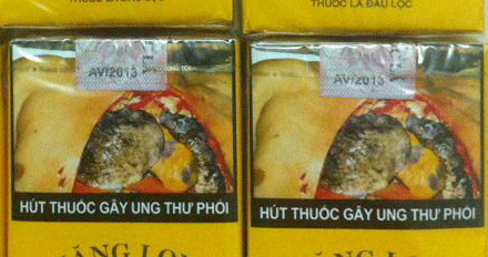 “Sốc” với tác hại thật của thuốc lá - 2 Hình ảnh cảnh báo được in trên bao thuốc lá ở Việt Nam
