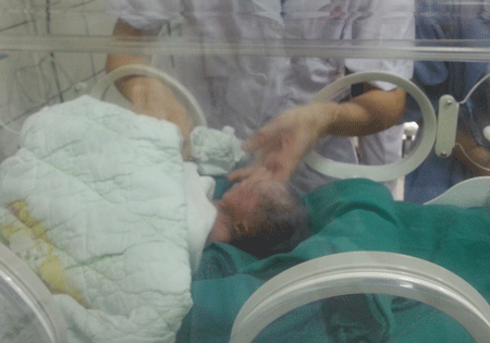 Chăm sóc trẻ sinh non tại khoa Nhi (BV Bạch Mai). Ảnh minh họa: H.Hải