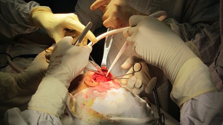 “Giải cứu” hàm răng bị dính chặt suốt 30 năm - 2 Ca phẫu thuật tách hàm cho người bệnh kéo dài đến 8 tiếng đồng hồ. Ảnh: Song Ngọc.