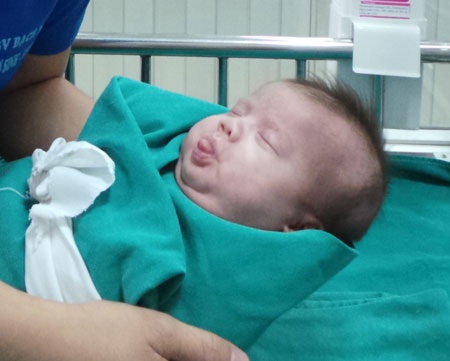 Cứu sống trẻ 800gram suy thận cấp ngay khi vừa lọt lòng - 1 Bé Phạm Thị Vy trong ngày xuất viện, nặng 3,1kg, hoàn toàn khỏe mạnh, ăn ngủ tốt. Ảnh: H.Hải