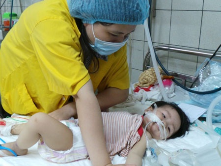 Em bé bụ bẫm, dễ thương lơ mơ vì phải thở máy do viêm phổi biến chứng sởi. Ảnh: H.Hải