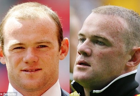 Wayne Rooney hi vọng hết “hói” - 1