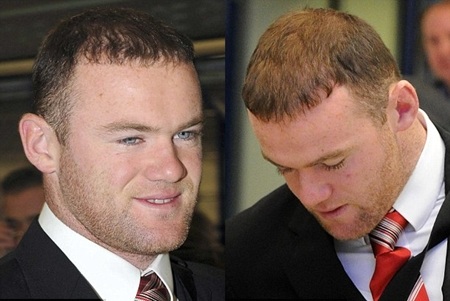 Vợ chồng Wayne Rooney đua nhau.....hói - 6 Vợ chồng Wayne Rooney đua nhau.....hói - 6