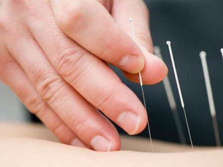 Bác sĩ bỏ quên bệnh nhân với chi chít kim châm