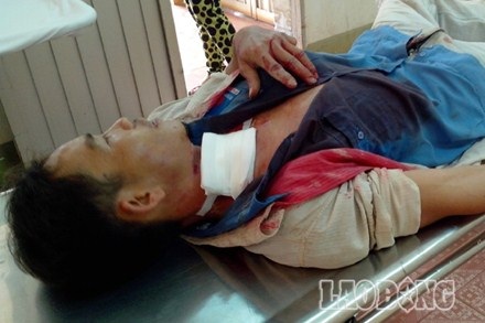 Đang đi đường, hai người bất ngờ bị dây điện cắt ngang cổ - 1 Anh Trần Ngọc Vũ đang chờ chuyển viện