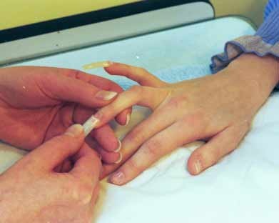 Gắn móng giả dễ bị ung thư da  - 1