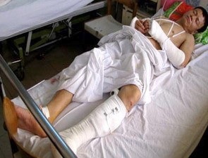 Cơ thủ Lê Dũng sẽ bị thương tật vĩnh viễn - 1 Cơ thủ Lê Dũng sẽ bị thương tật vĩnh viễn - 1