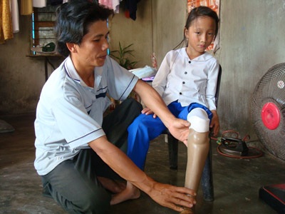 “Con ước có cái chân giả để đến trường” - 2 “Con ước có cái chân giả để đến trường” - 2