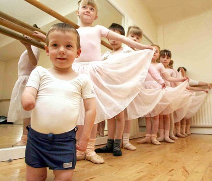 Cậu bé 4 tuổi cụt hai chân vẫn múa balê (video) - 1