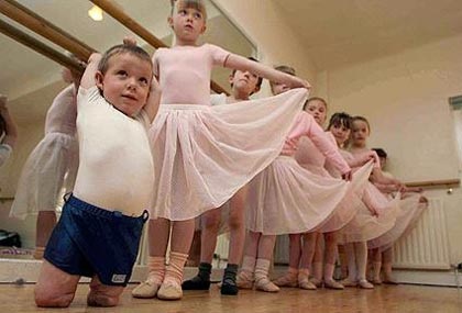 Cậu bé 4 tuổi cụt hai chân vẫn múa balê (video) - 2