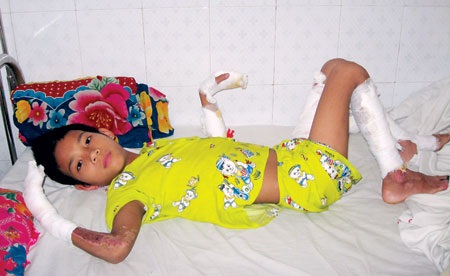 Cám cảnh gia đình cháu bé bị anh họ thiêu đốt - 1