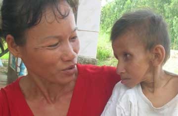 Thiếu niên 15 tuổi mang gương mặt của ông già 70 - 1