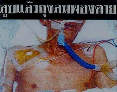 Người dân “mù tịt” về tác hại của thuốc lá - 1 Người dân “mù tịt” về tác hại của thuốc lá - 1