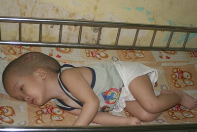 Những đứa trẻ mang “dòng máu tử thần”  - 5