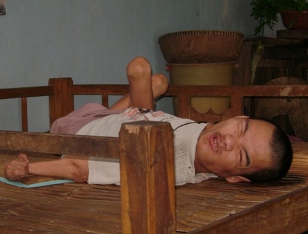 Những người mẹ và nỗi đau da cam - 3 Những người mẹ và nỗi đau da cam - 3