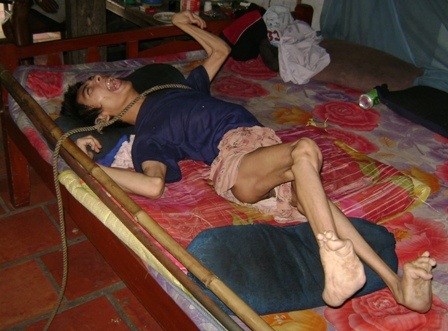 Những người mẹ và nỗi đau da cam - 4 Những người mẹ và nỗi đau da cam - 4