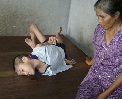 Những người mẹ và nỗi đau da cam - 1 Những người mẹ và nỗi đau da cam - 1