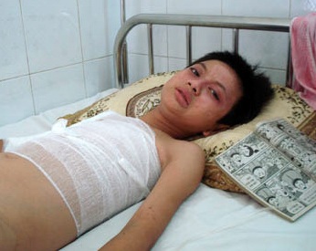 Bỏng nặng vì... dựa cột điện đọc truyện - 1 Bỏng nặng vì... dựa cột điện đọc truyện - 1