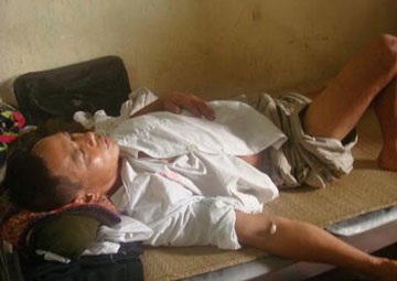 Côn đồ hành hung thương binh, chính quyền xử lý quá chậm - 1