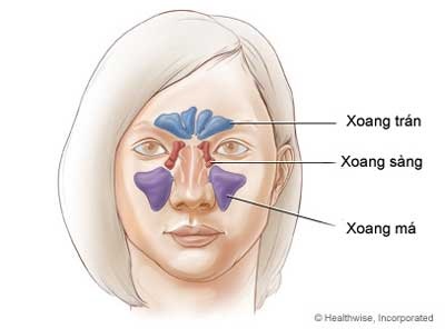 Thế nào là viêm xoang? - 1 Thế nào là viêm xoang? - 1