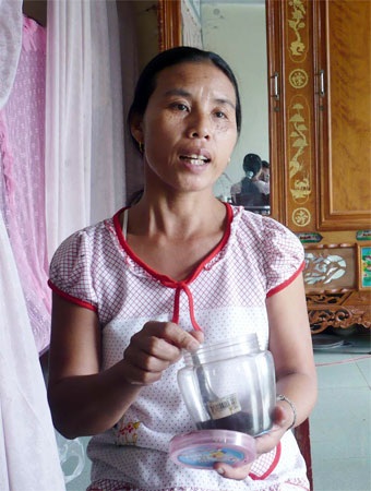 Cảnh báo tình trạng tự phát ăn gan, mật cóc tươi - 2 Cảnh báo tình trạng tự phát ăn gan, mật cóc tươi - 2