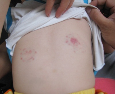 Bé trai 22 tháng tuổi bị sứt tai ở trường mầm non - 2