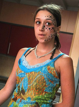 "Xăm nhầm" 56 ngôi sao trên mặt - 2