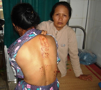 Trĩu lòng trước gia cảnh hai mẹ con bị sét đánh - 3 Trĩu lòng trước gia cảnh hai mẹ con bị sét đánh - 3