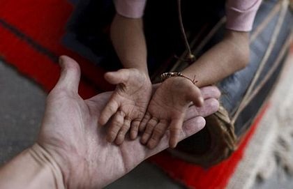 17 tuổi cân nặng 4,5 kg - 7