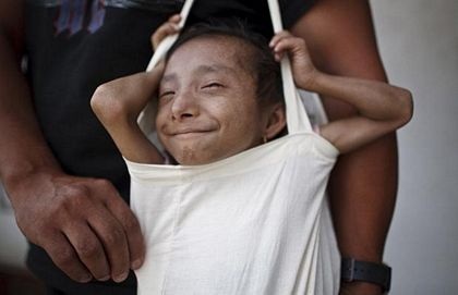 17 tuổi cân nặng 4,5 kg - 10