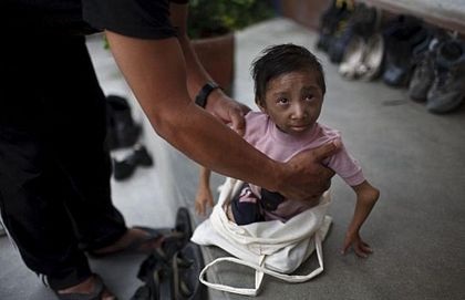 17 tuổi cân nặng 4,5 kg - 9