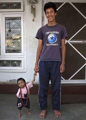 17 tuổi cân nặng 4,5 kg - 6