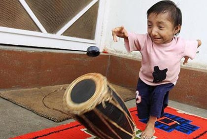 17 tuổi cân nặng 4,5 kg - 12