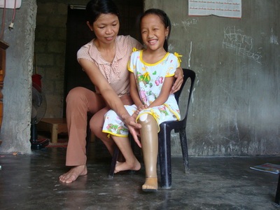 Ước mơ có chiếc chân giả của bé Văn Nhật Thảo đã thành hiện thực - 2 Ước mơ có chiếc chân giả của bé Văn Nhật Thảo đã thành hiện thực - 2