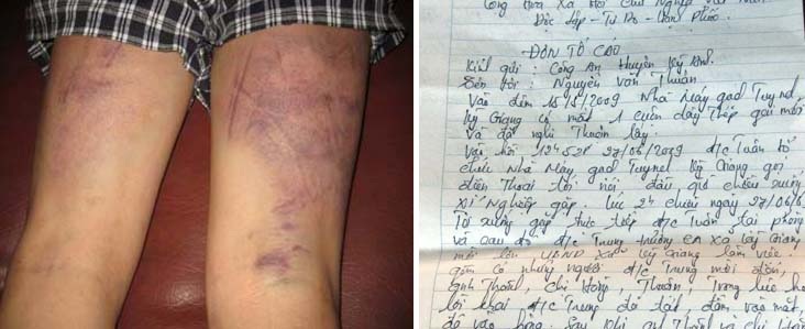 Trưởng công an xã dùng “nghiệp vụ đặc biệt” để tra khảo dân - 2