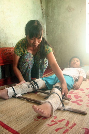 Hoàng ơi, đừng gục ngã… - 2 Hoàng ơi, đừng gục ngã… - 2