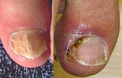 Ẩn họa từ làm đẹp móng - 1 Ẩn họa từ làm đẹp móng - 1