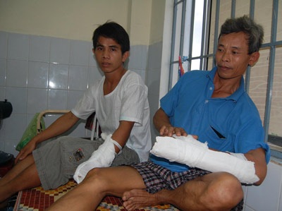 Bị đánh chém dã man vì kêu mất điện thoại - 1 Bị đánh chém dã man vì kêu mất điện thoại - 1